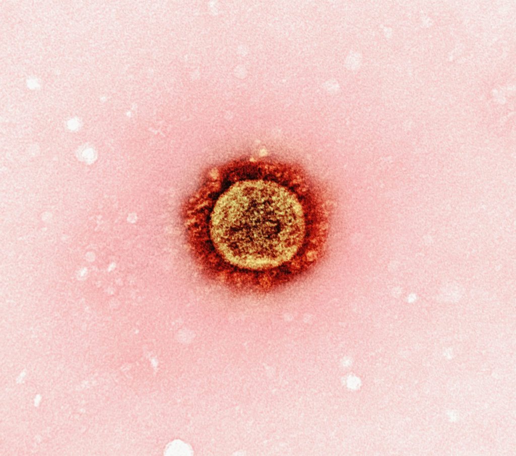 a close up of a red substance on a pink background